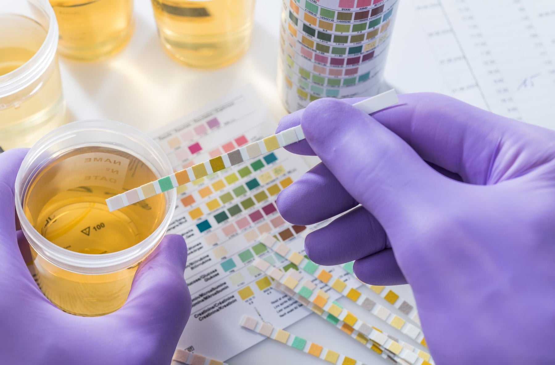 Reasons Why Your Doctor Might Recommend a Rapid 9-Panel Drug Test