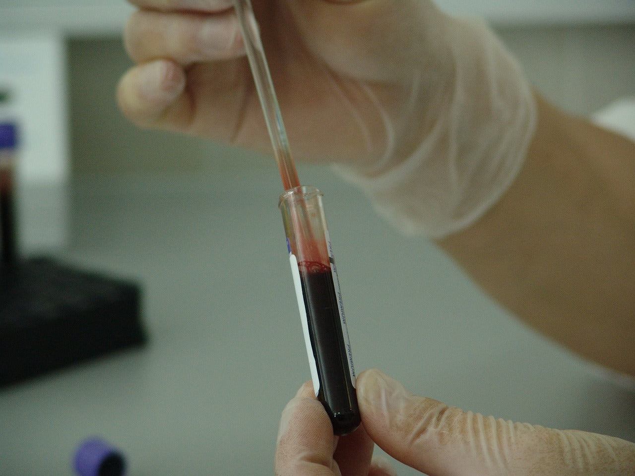 blood vial