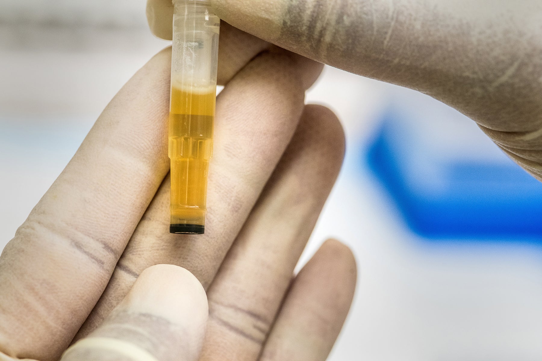 Urine drug test