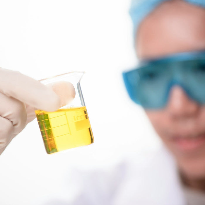 urine sample