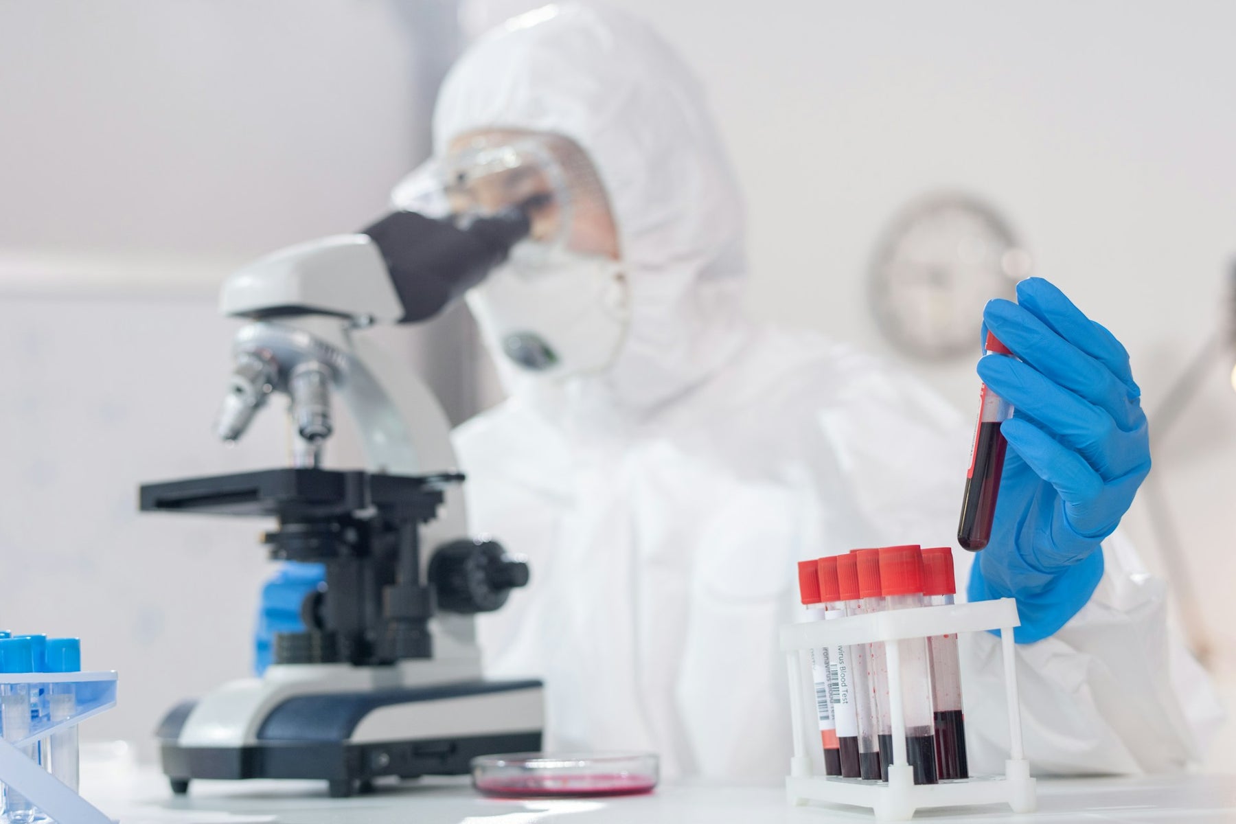 Lab Test