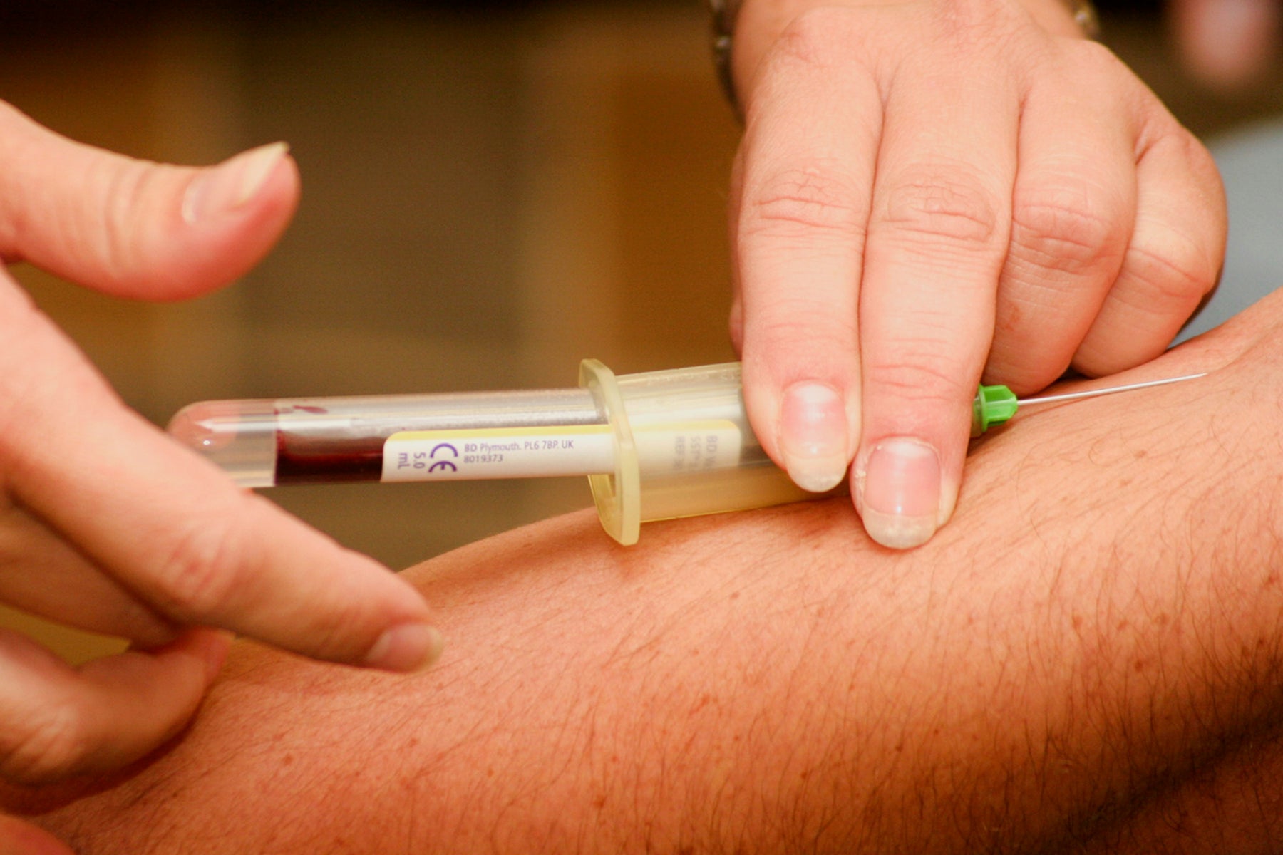 blood extraction