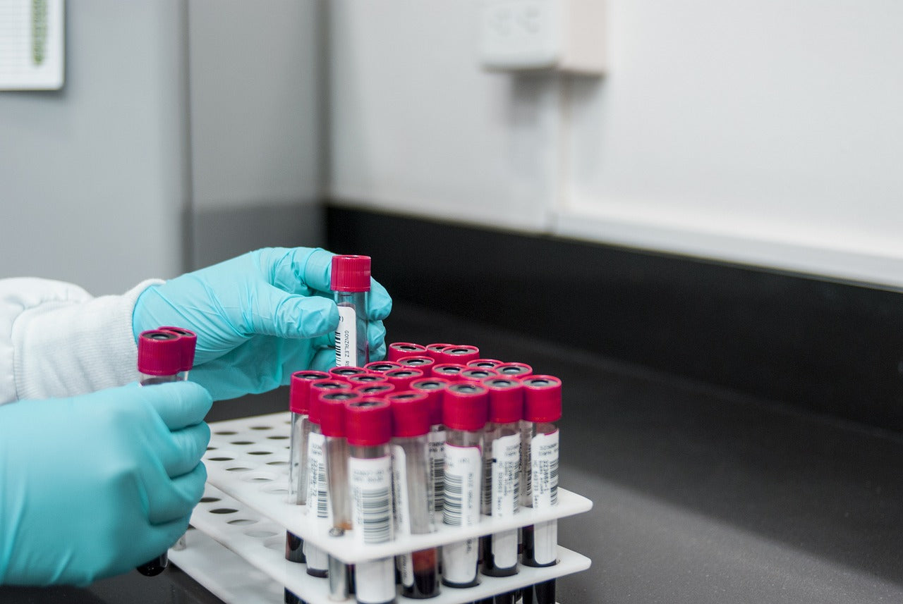 lab testing