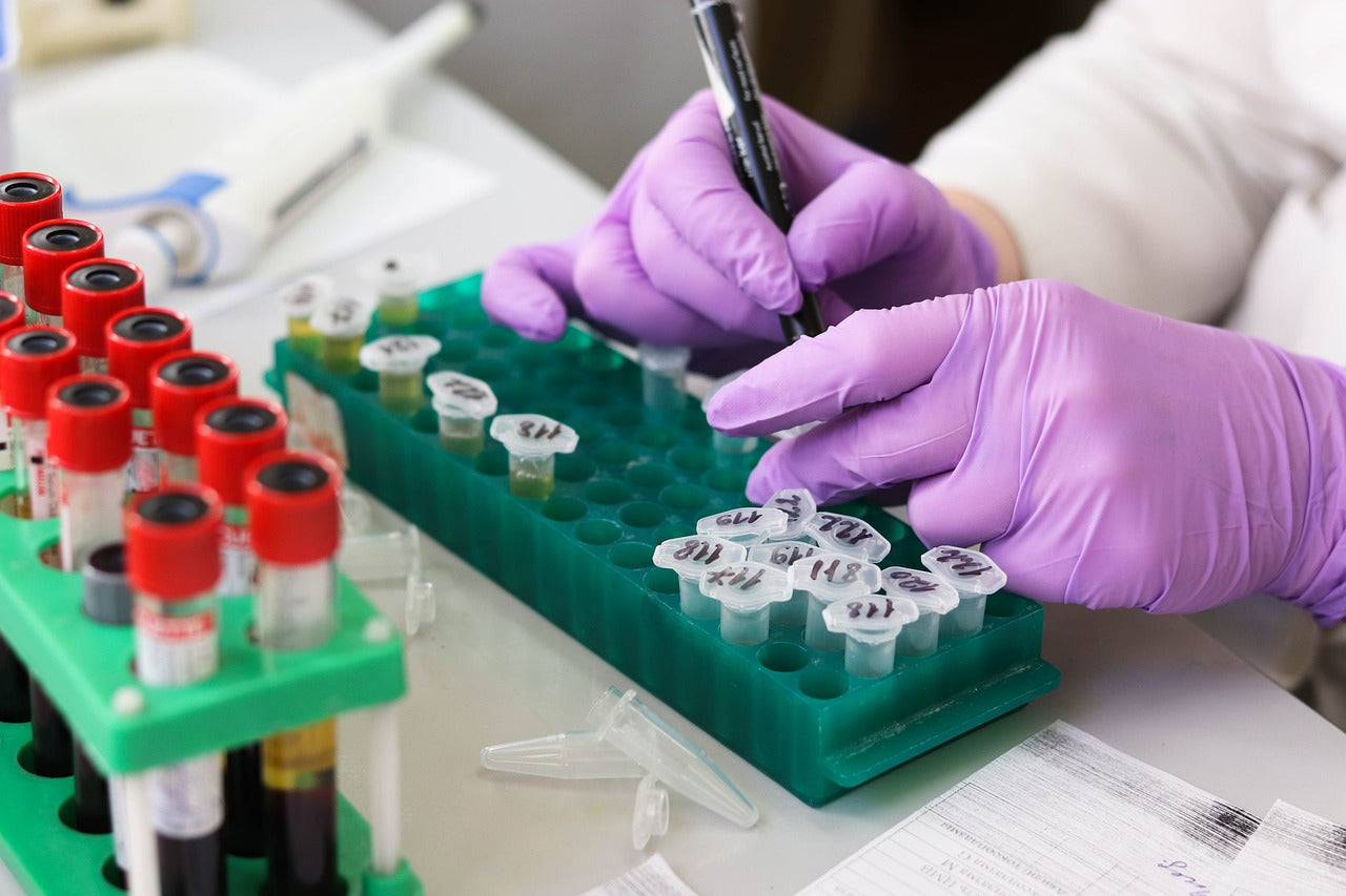 Hormonal Balance: How RSC Health's Private Lab Testing Services Help Maintain Optimal Health