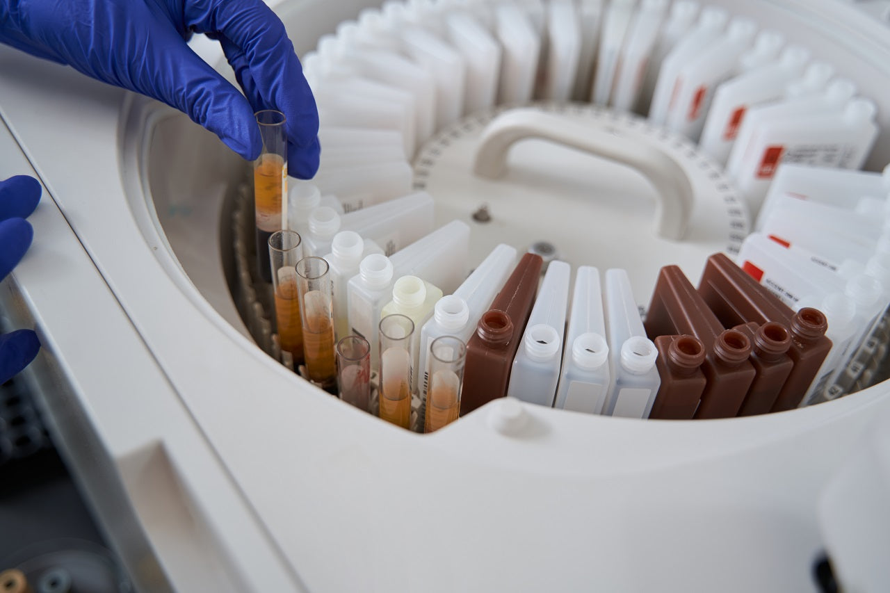 lipid panel