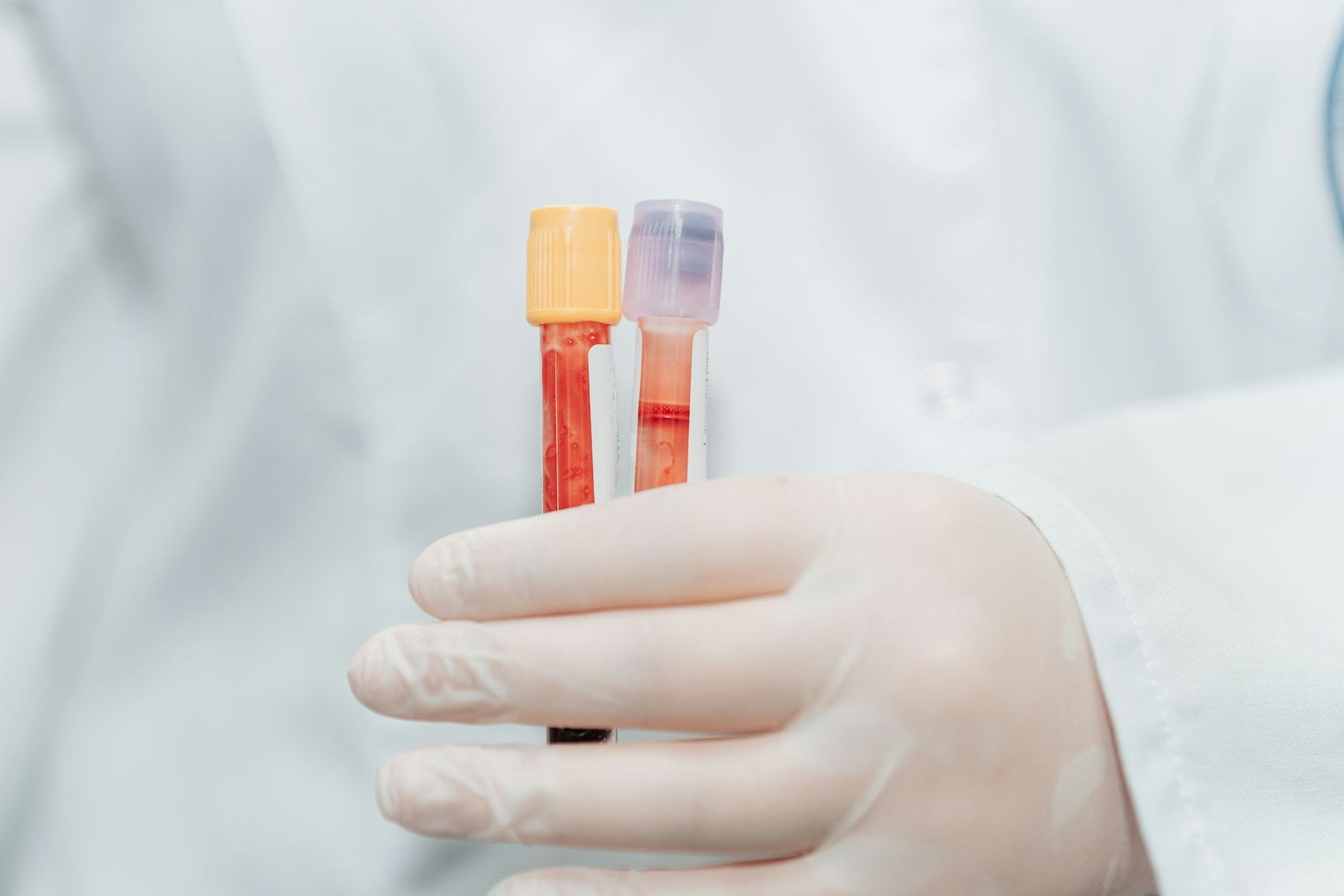 blood test