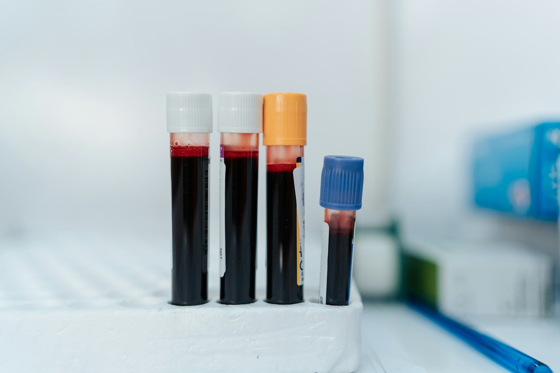 Lab Tests