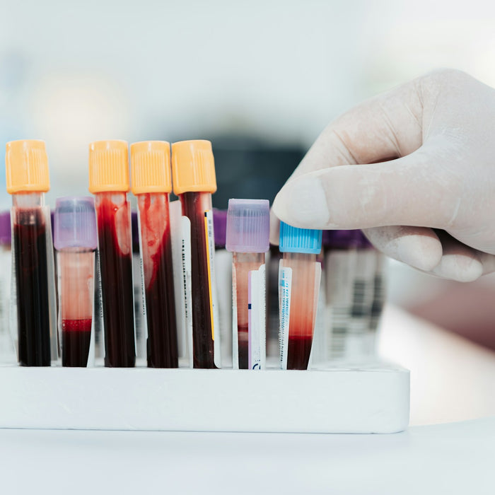 lab test