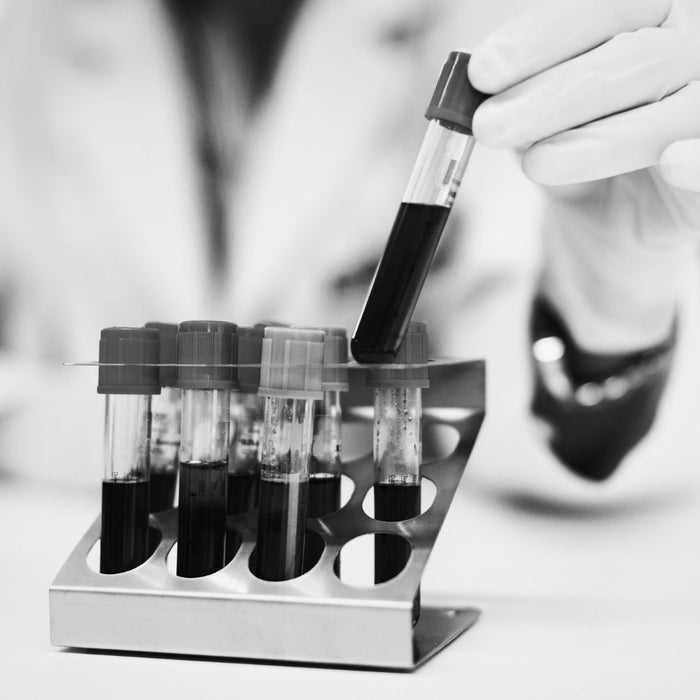 Lab Tests