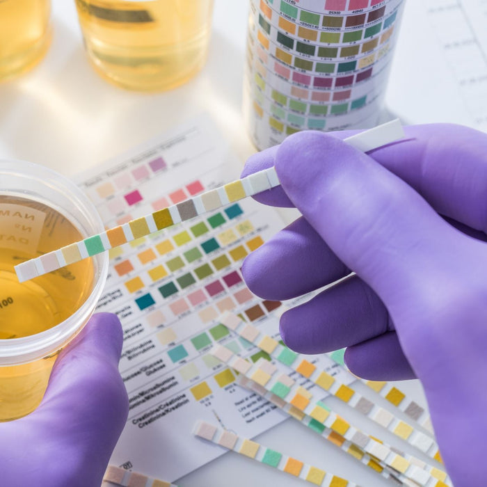 Reasons Why Your Doctor Might Recommend a Rapid 9-Panel Drug Test