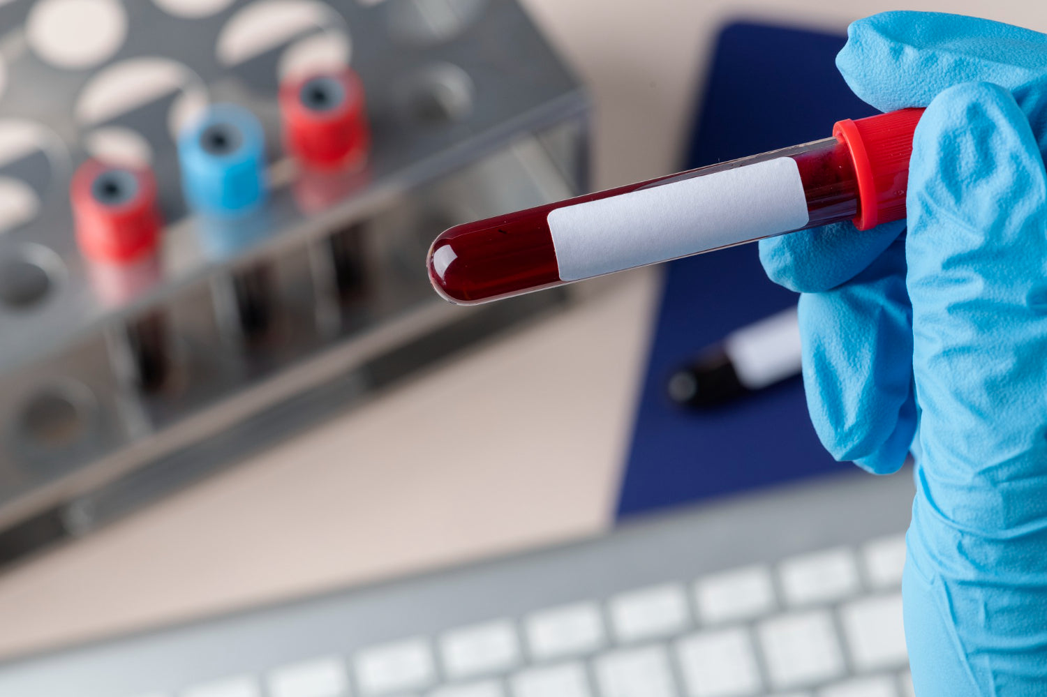 Understanding the Combative Trio Blood Test – RSC Health