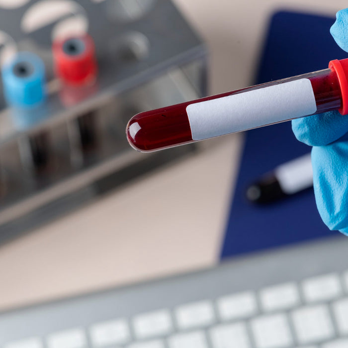 Blood Test