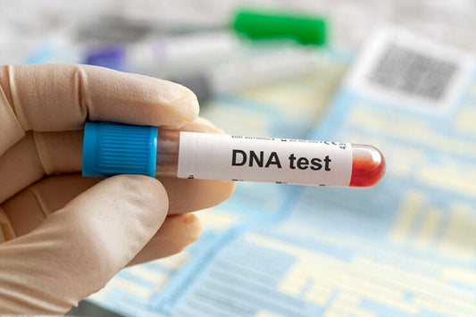 DNA test