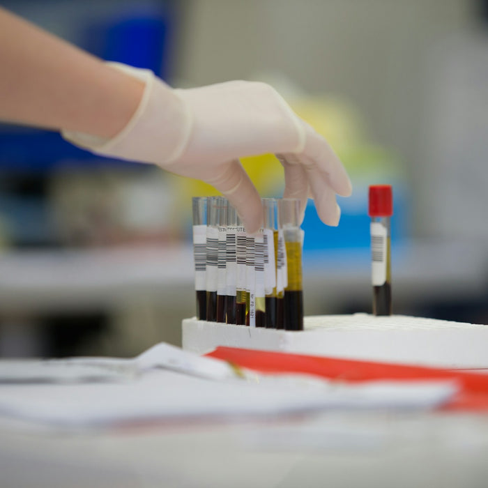 Lab Testing