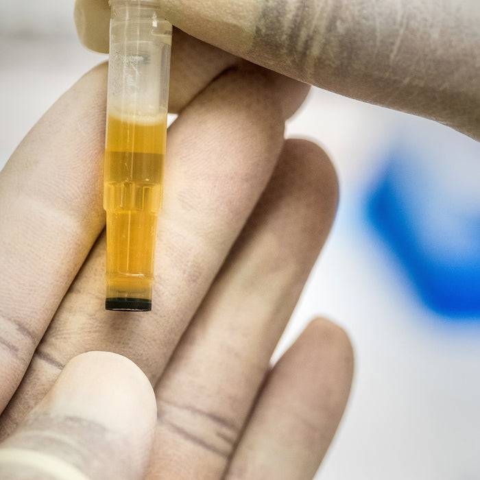 Urine drug test