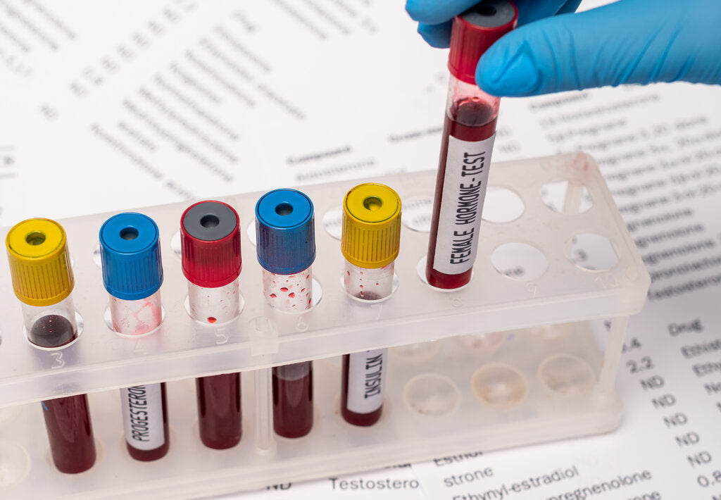hormone test tube