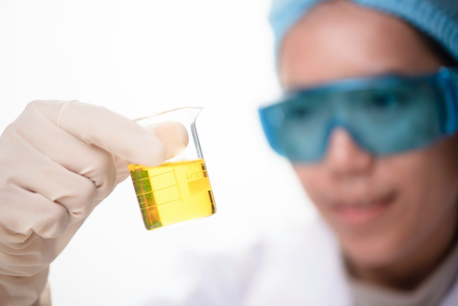 urine sample