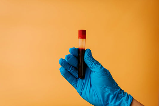 How a 5-Panel Drug Test Could Impact Employment Decisions