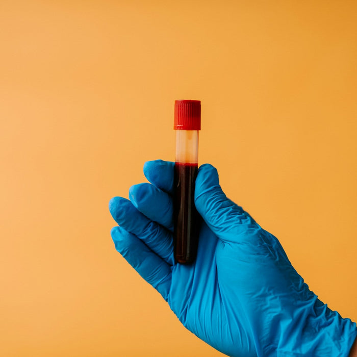 How a 5-Panel Drug Test Could Impact Employment Decisions