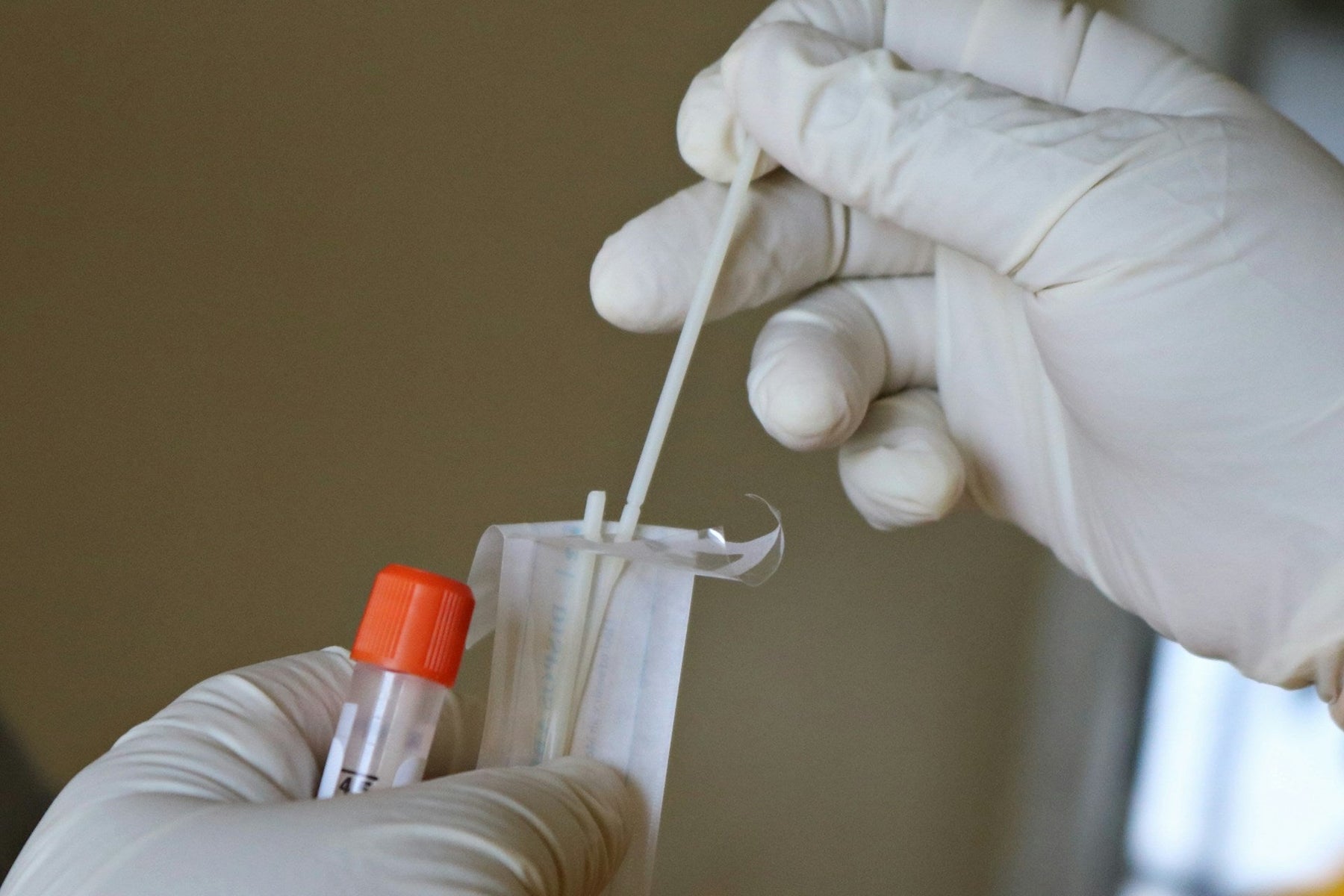 The Importance of Quick DNA Testing for Family Planning