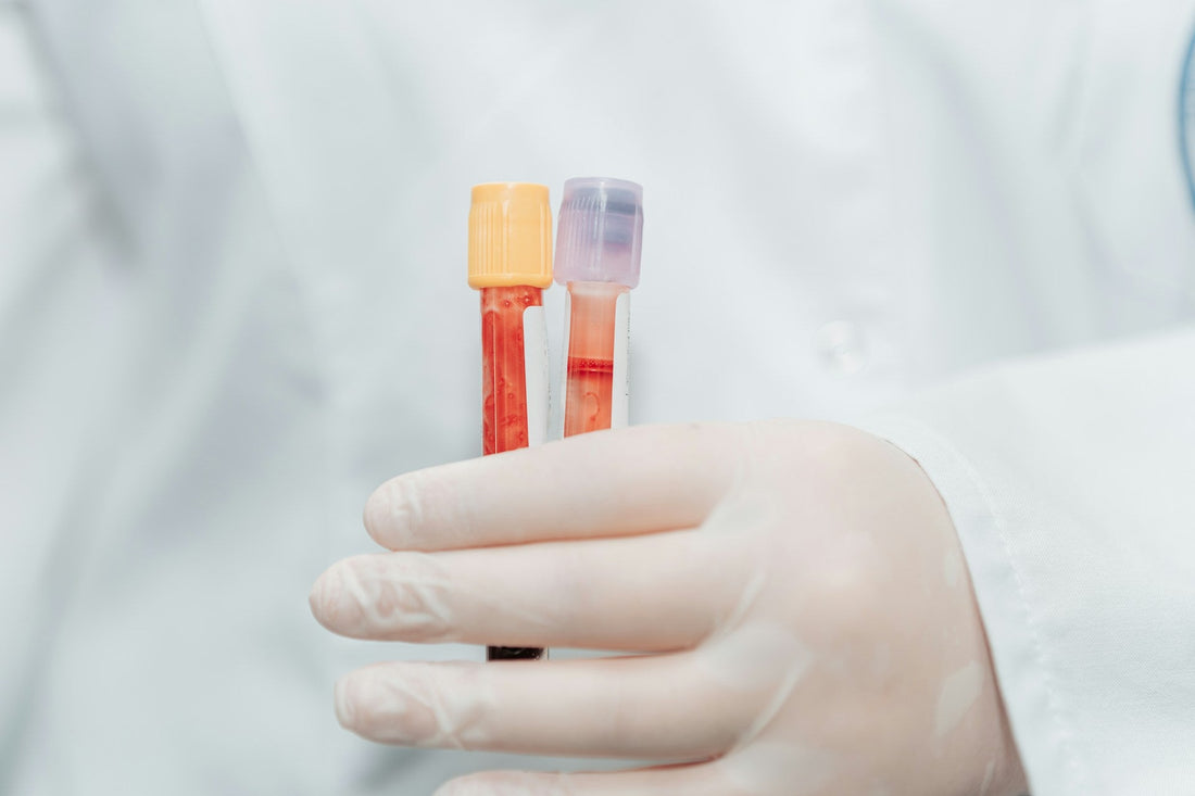 blood test