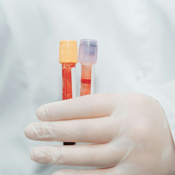 blood test
