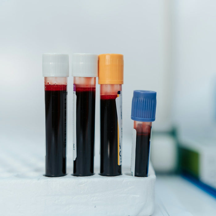 Lab Tests