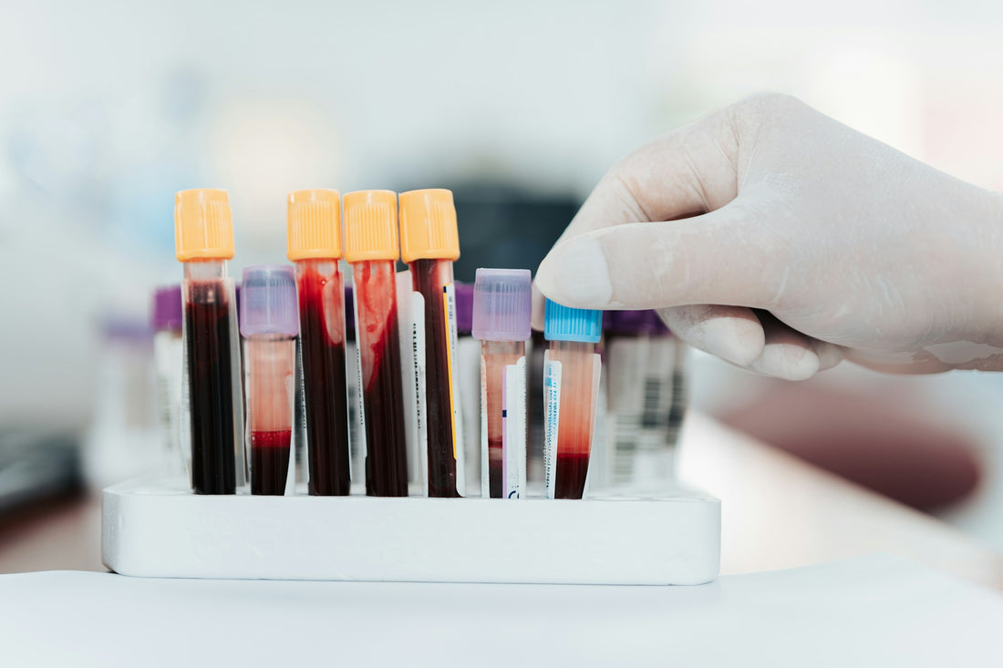 lab test