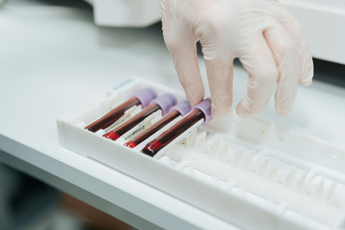 blood extract